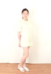 【J020】黄色ミニスカナース